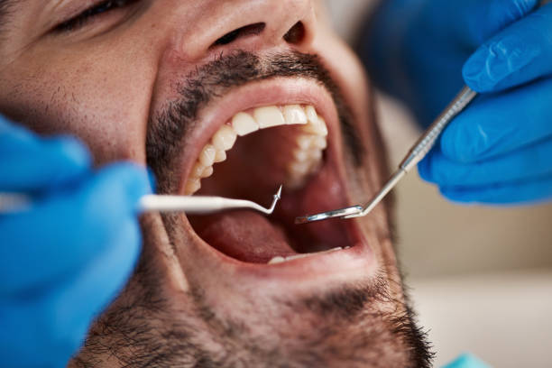 Best Broken or Chipped Tooth Repair in Leland Grove, IL